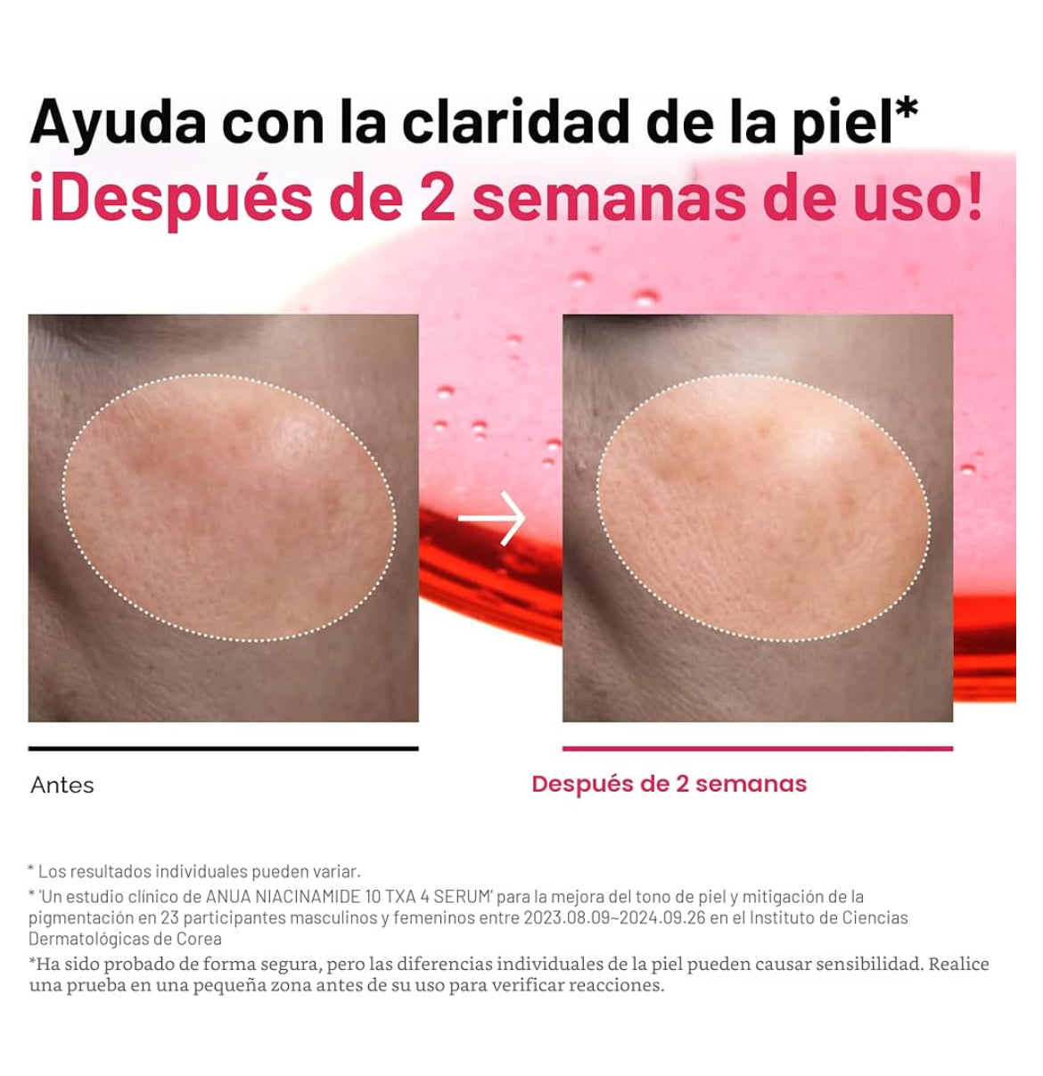 ✨ Sérum con Niacinamida 10% + Ácido Tranexámico 4% ✨
