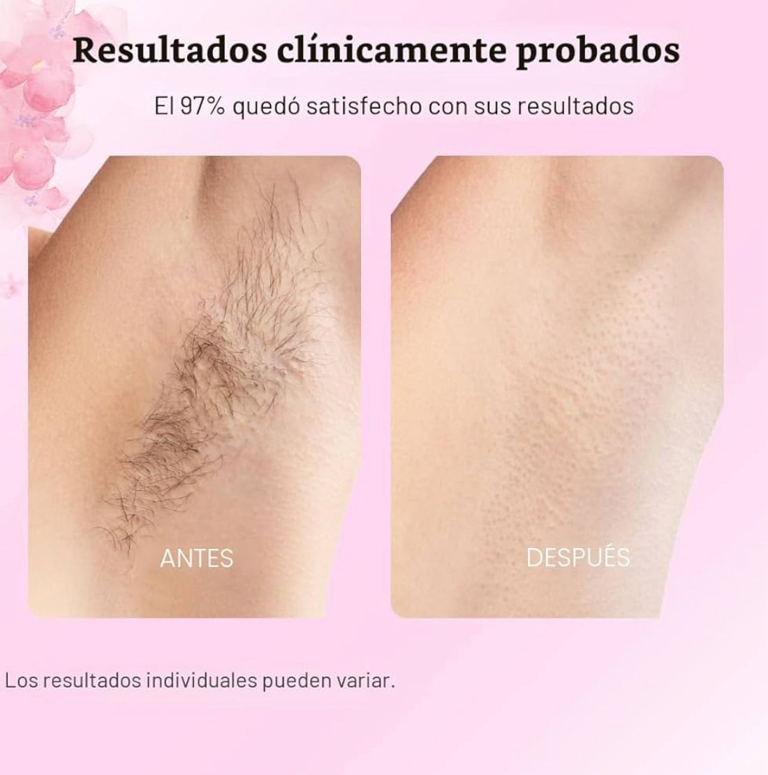 ✨ CARAMELA BEAUTY – CYPERUS ROTUNDUS ELIXIR🌸