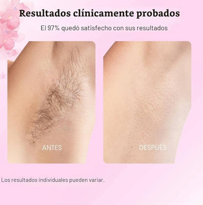 ✨ CARAMELA BEAUTY – CYPERUS ROTUNDUS ELIXIR🌸